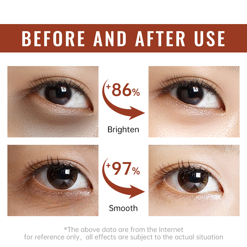 Retinol Firming Eye Cream Anti - Women Bags Under Eyes 评论和价格